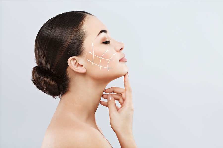 Mulher de perfil com indicação visual da direção do lifting facial